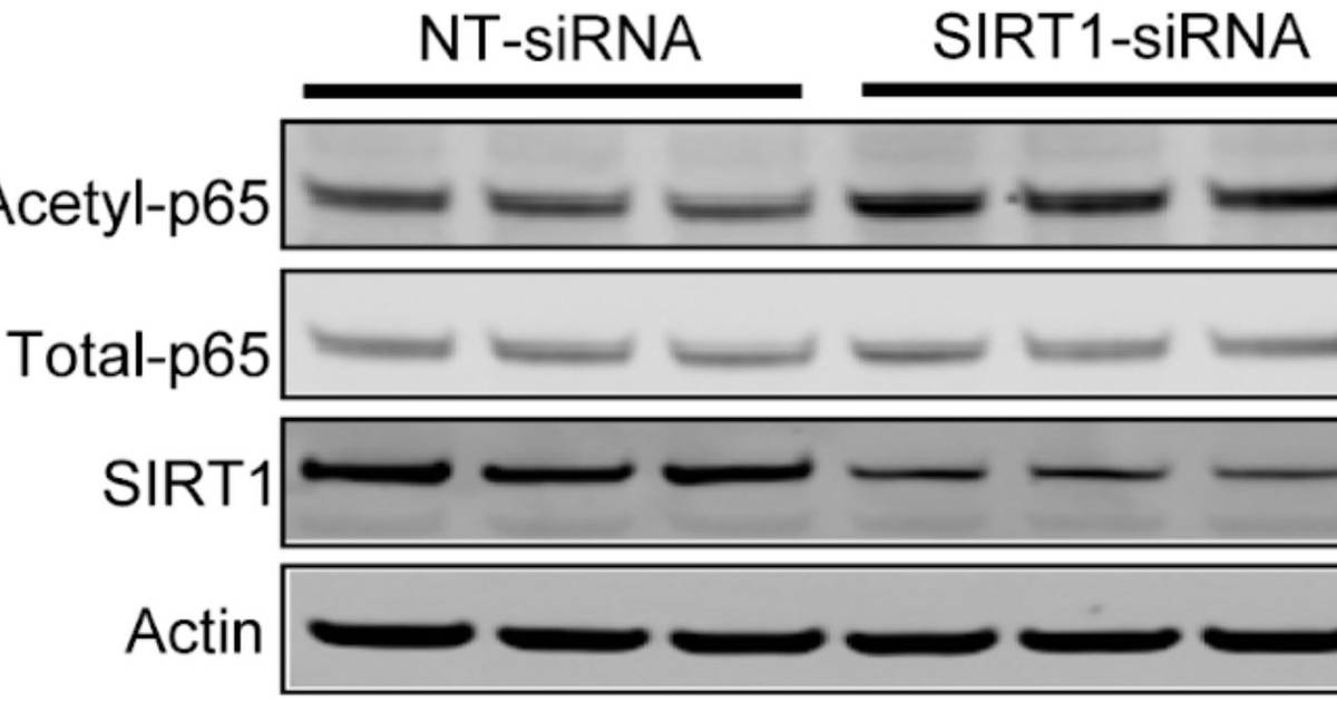 How to Interpret a Western Blot: The basics