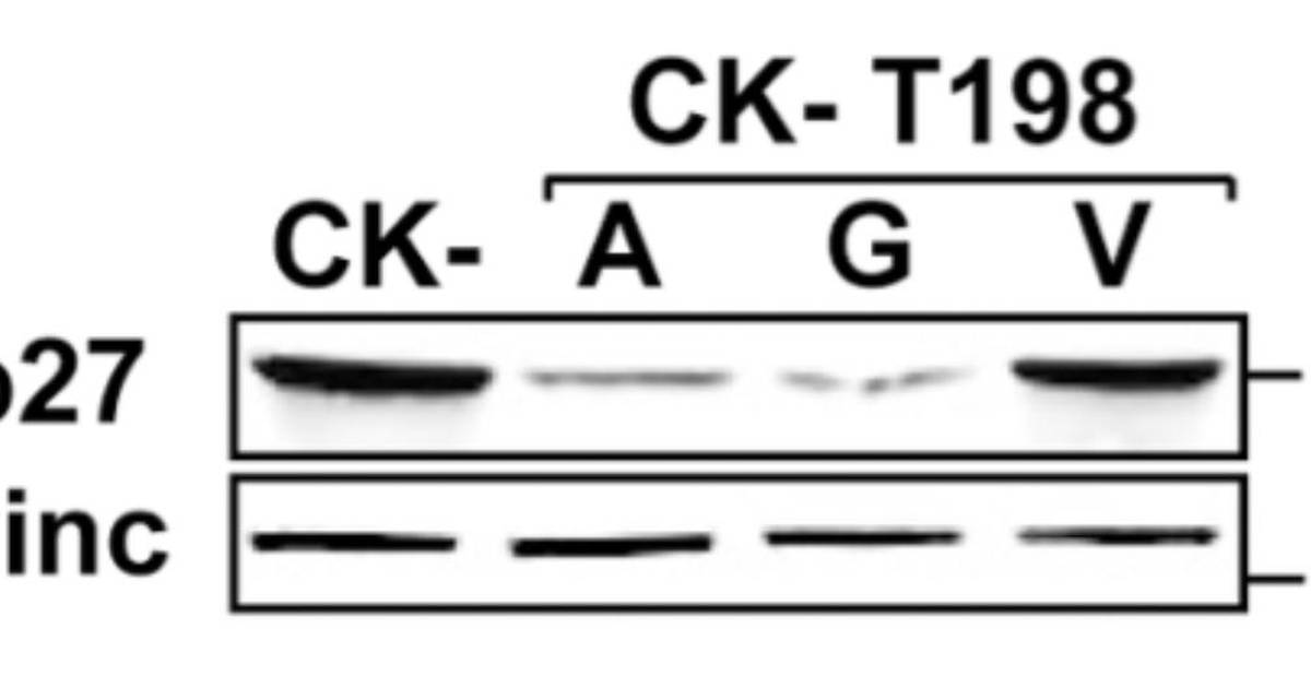 Check Your Understanding: Interpreting western blots