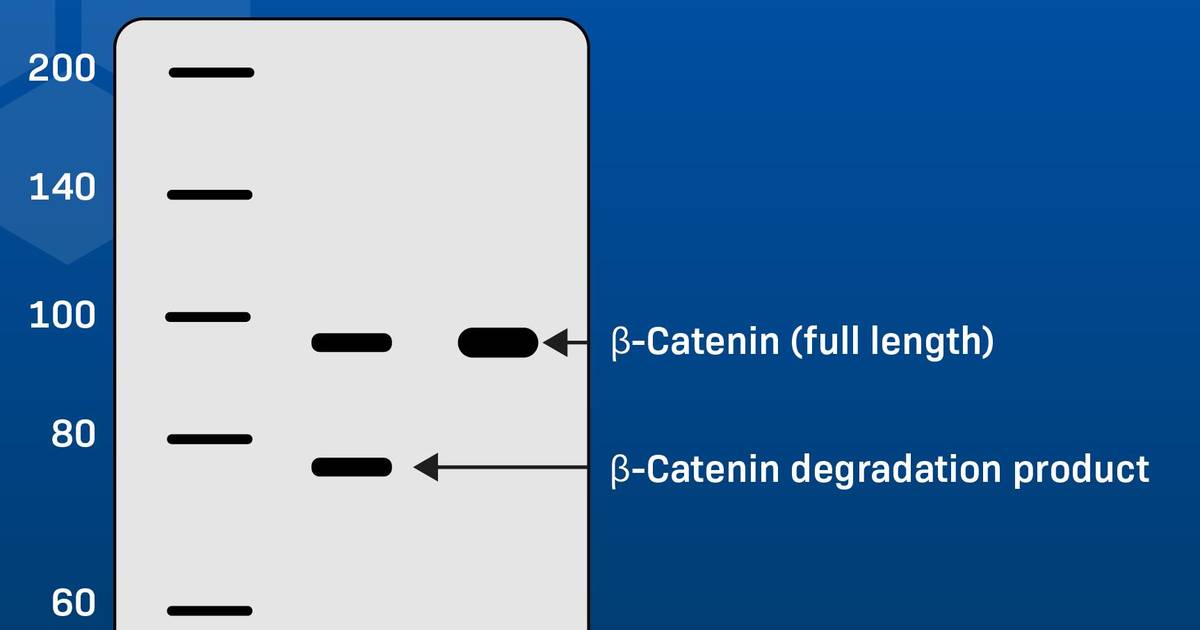 How to Interpret a Western Blot: Reading through common issues
