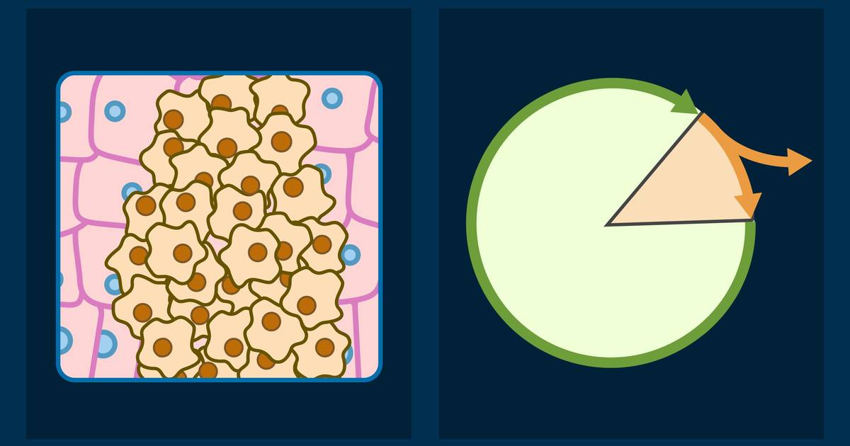 Cell Cycle and Cancer