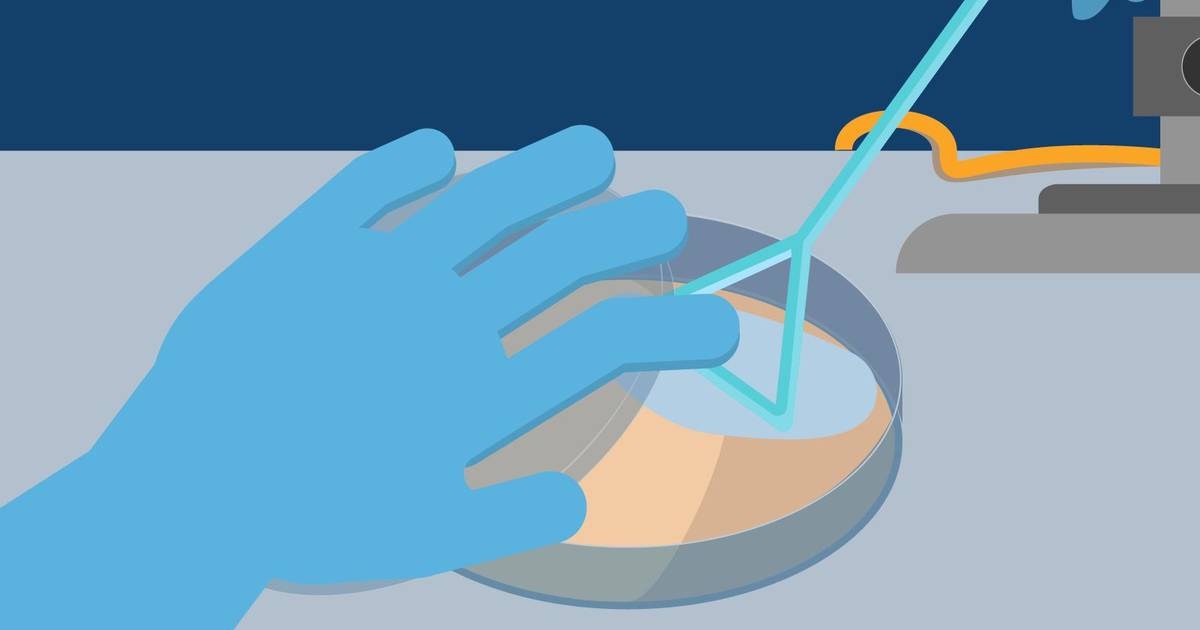 Aseptic Techniques: Spread Plating