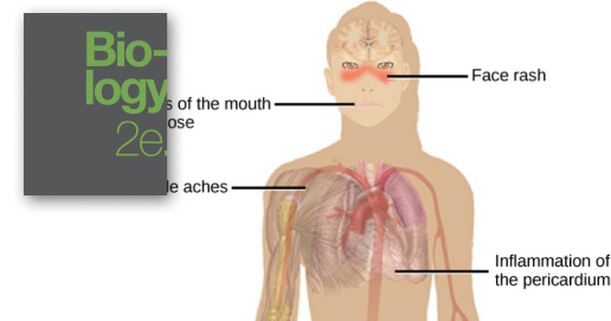 Disruptions in the Immune System
