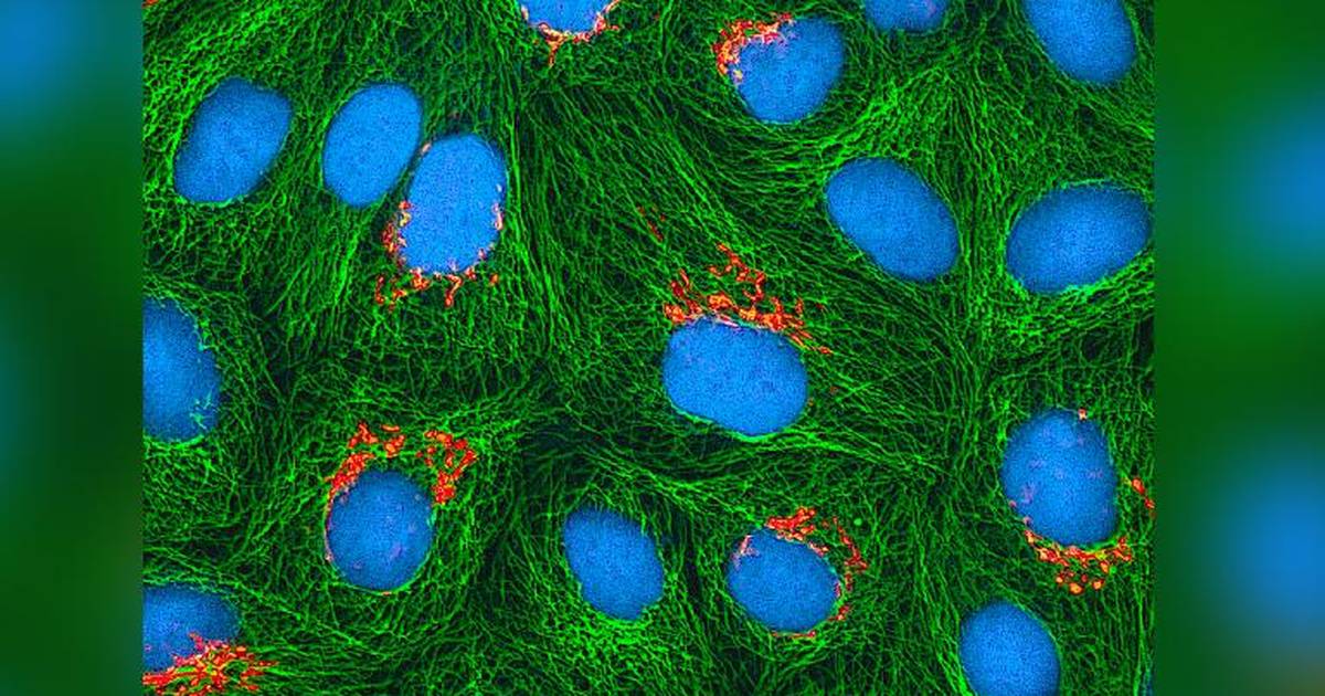 The Story of Henrietta Lacks: Uncovering the HeLa Cells