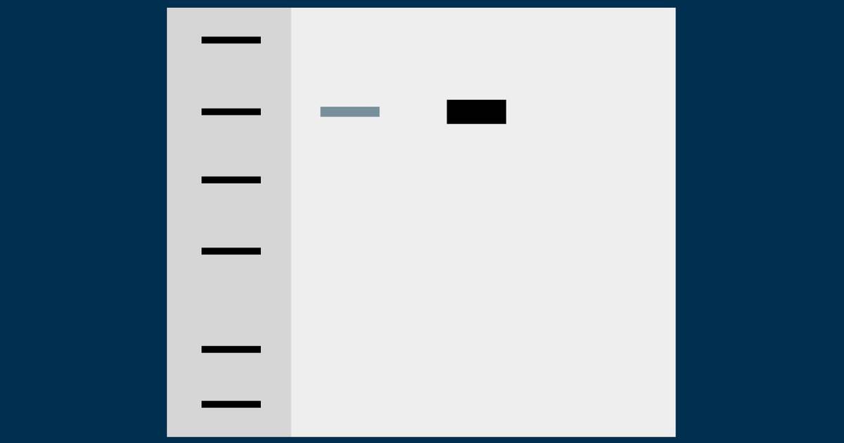 Immunoblot Interpretation