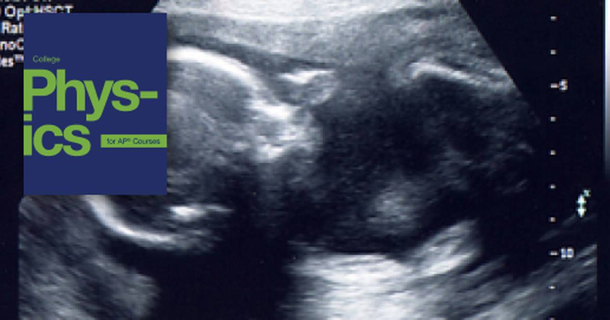 Ultrasound