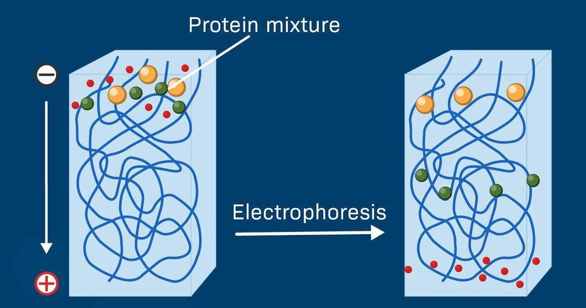 Protein Gel Electrophoresis