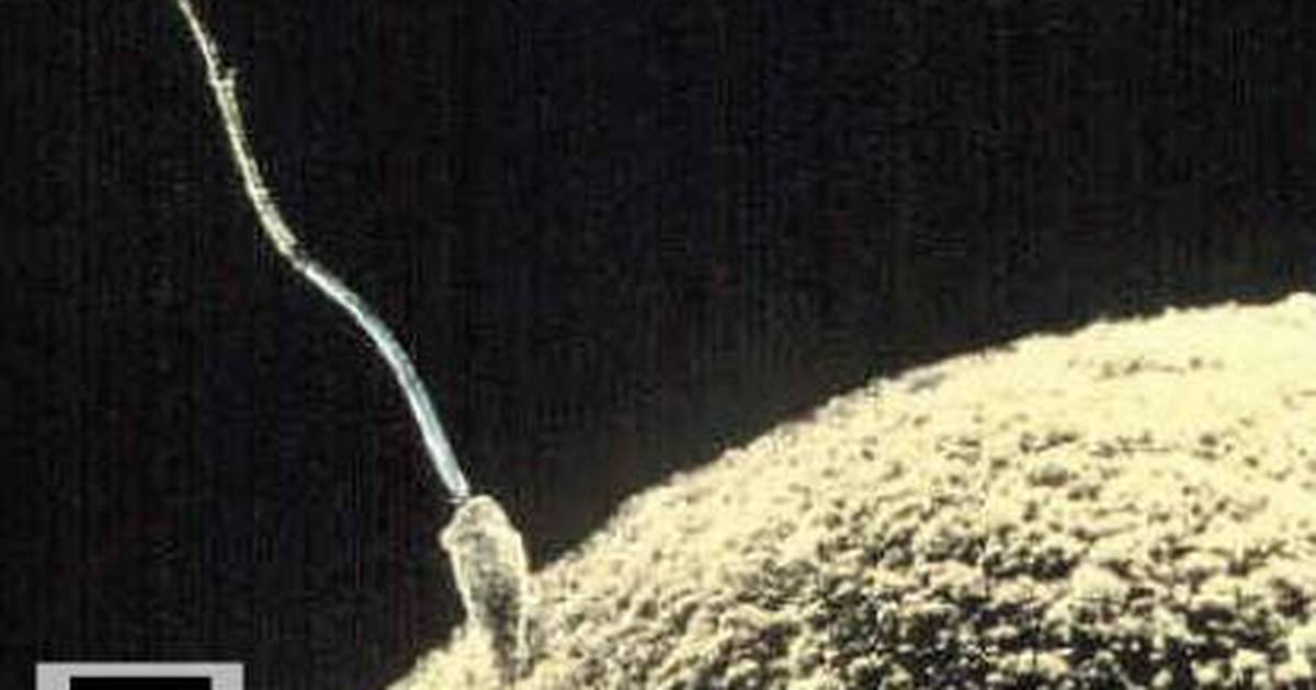 Gametogenesis: Spermatogenesis and Oogenesis