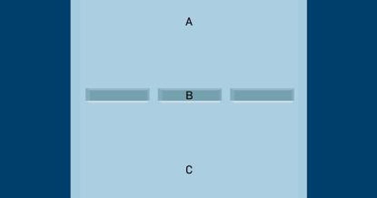 Gel Electrophoresis Charge