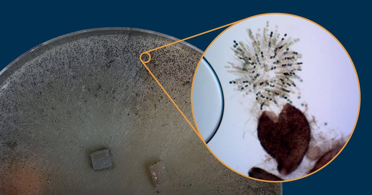 How To: Preparing Sordaria Samples to Measure Crossover Frequency