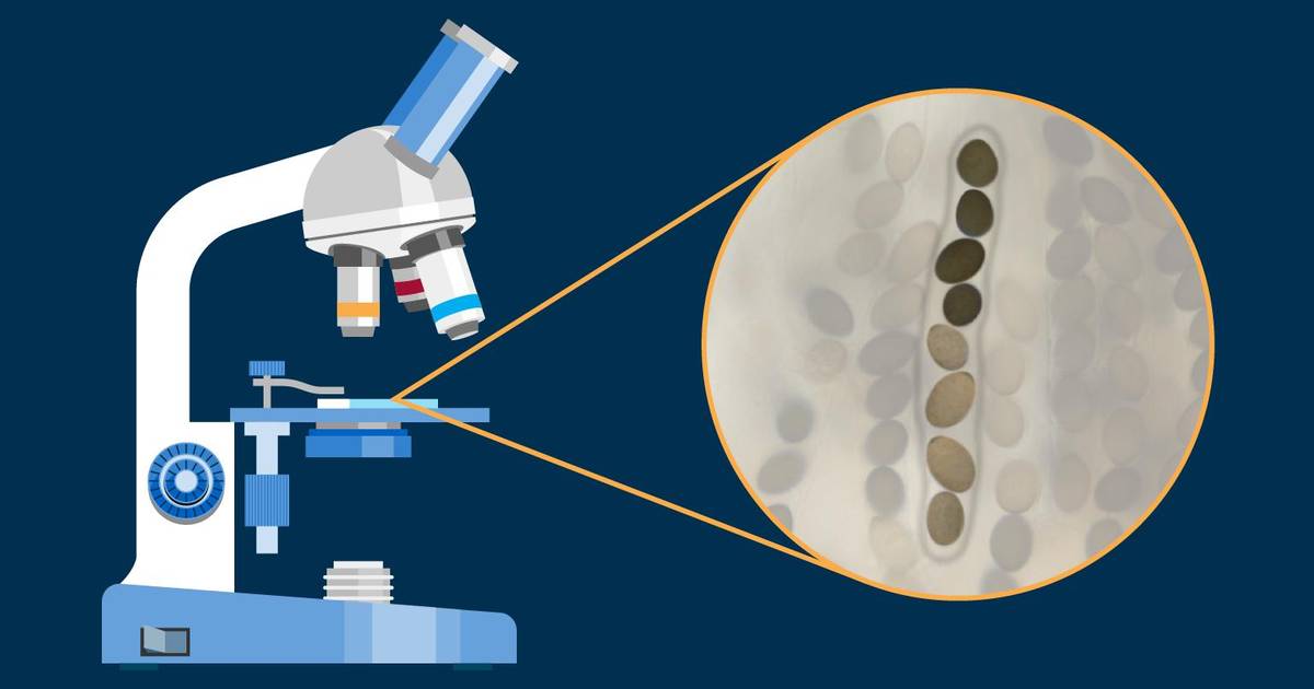 Meiosis: Measuring Crossover Frequencies in 𝘚𝘰𝘳𝘥𝘢𝘳𝘪𝘢 𝘧𝘪𝘮𝘪𝘤𝘰𝘭𝘢