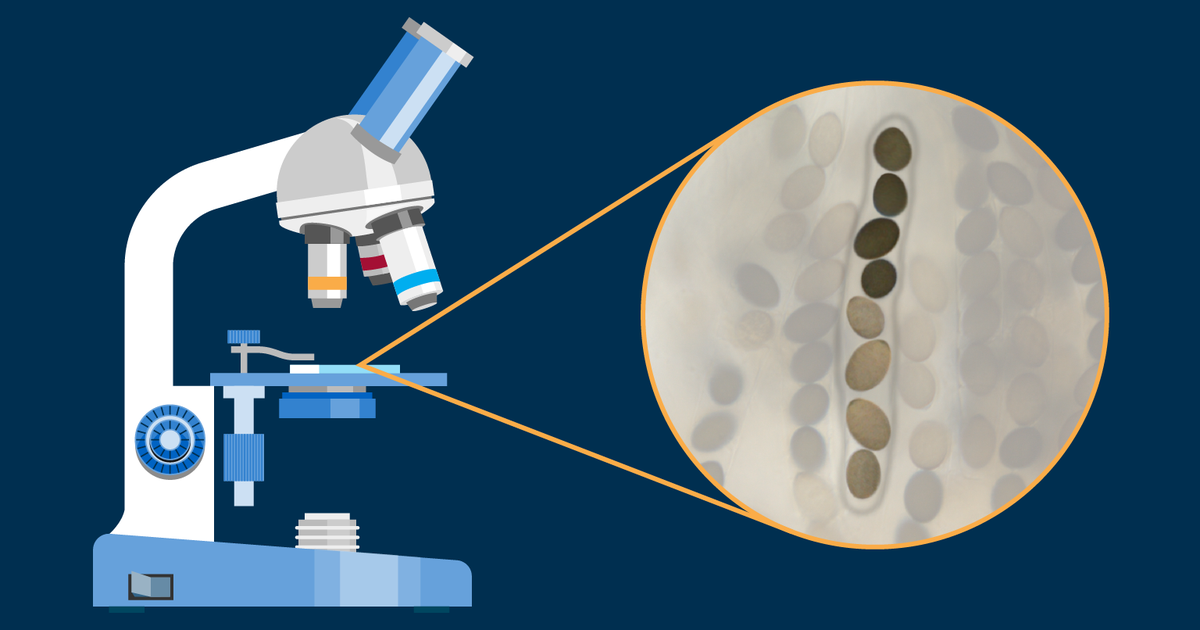 Worksheet | Meiosis: Measuring Crossover Frequencies in 𝘚𝘰𝘳𝘥𝘢𝘳𝘪𝘢 𝘧𝘪𝘮𝘪𝘤𝘰𝘭𝘢