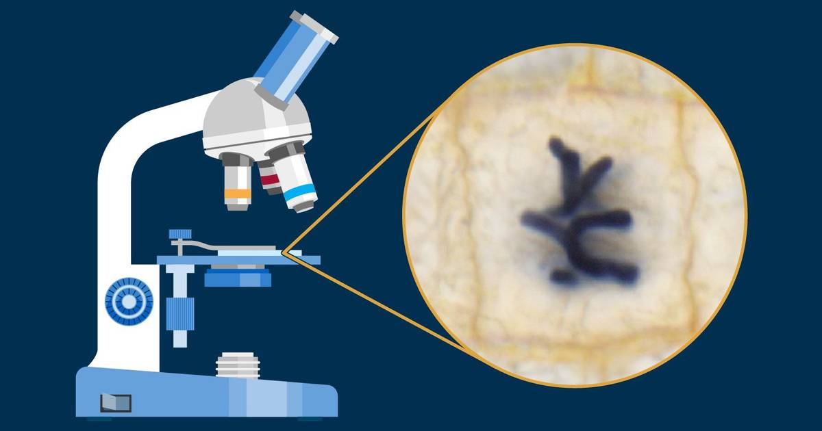 Mitosis Worksheet: Evaluating the Effects of Lectin on Onion Root Tip Cell Division
