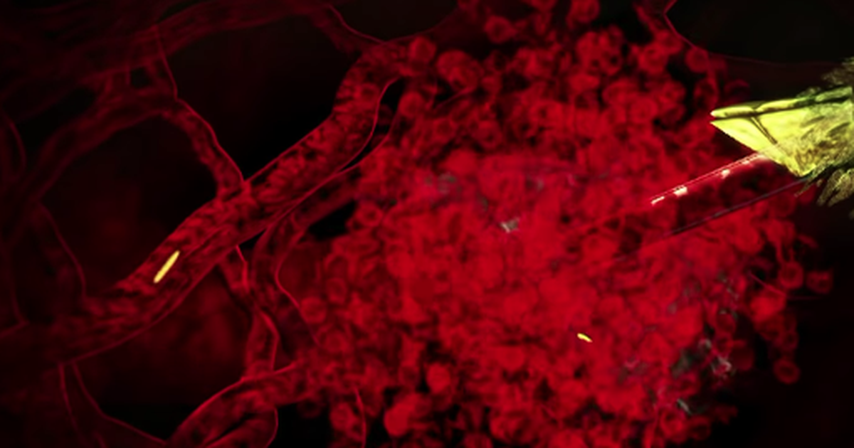 Malaria: An Introduction