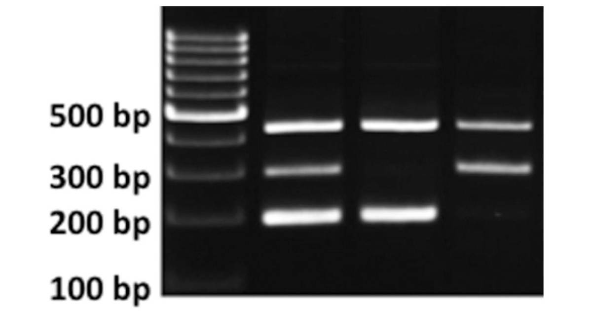 Check Your Understanding: Interpreting agarose gels