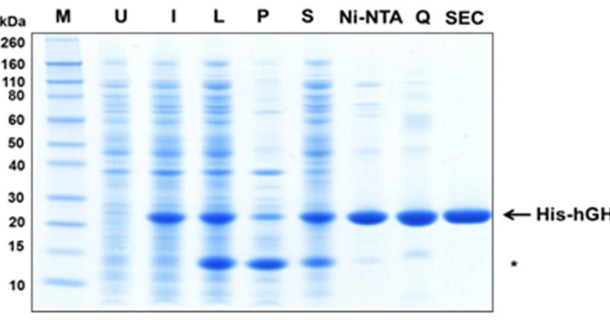 How to Interpret Polyacrylamide Gels: The basics