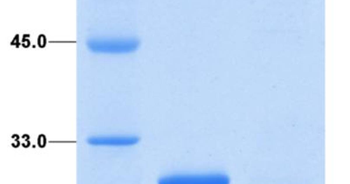 Check Your Understanding: Interpreting polyacrylamide gels