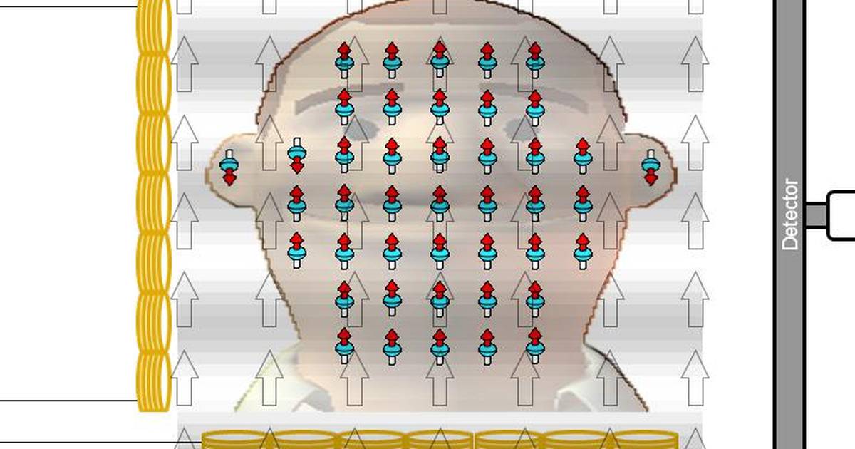 Simplified MRI