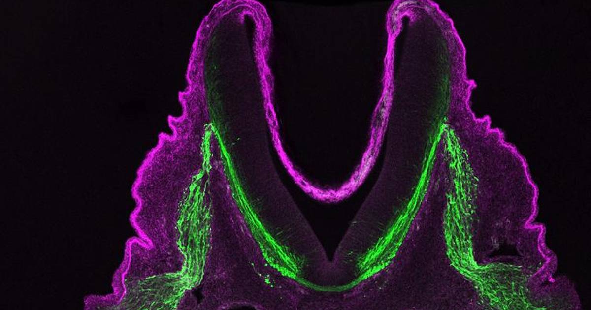 Laminins Lay Down Tracks for Future Nerves