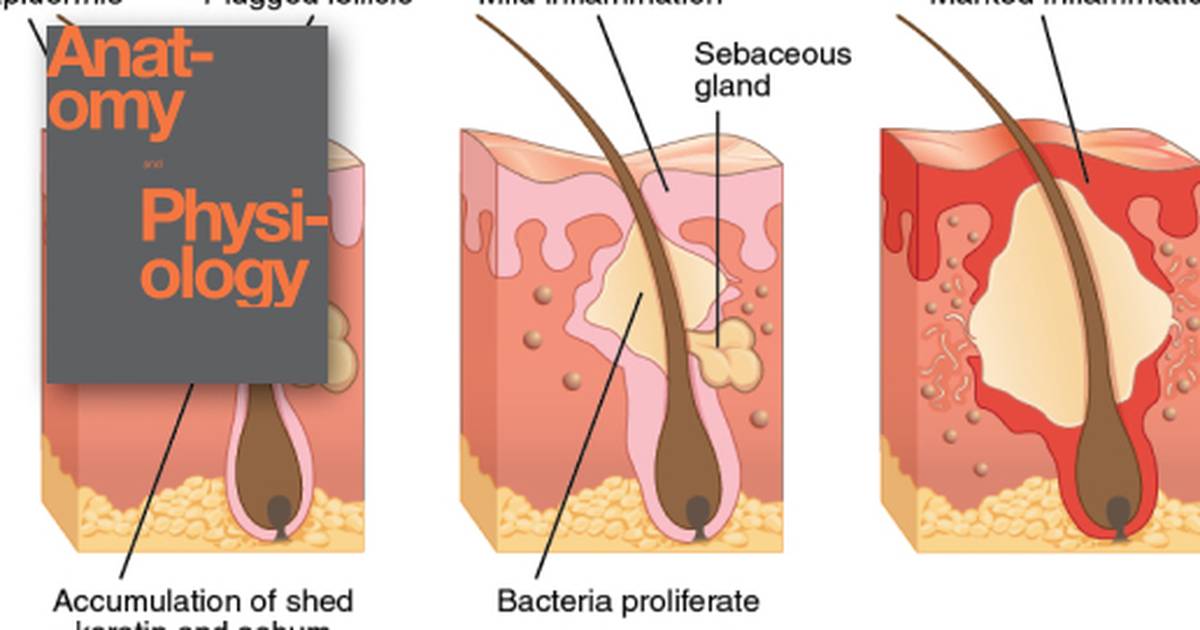Diseases, Disorders, and Injuries of the Integumentary System