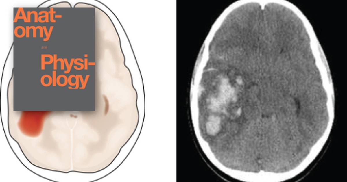 Overview of the Neurological Exam
