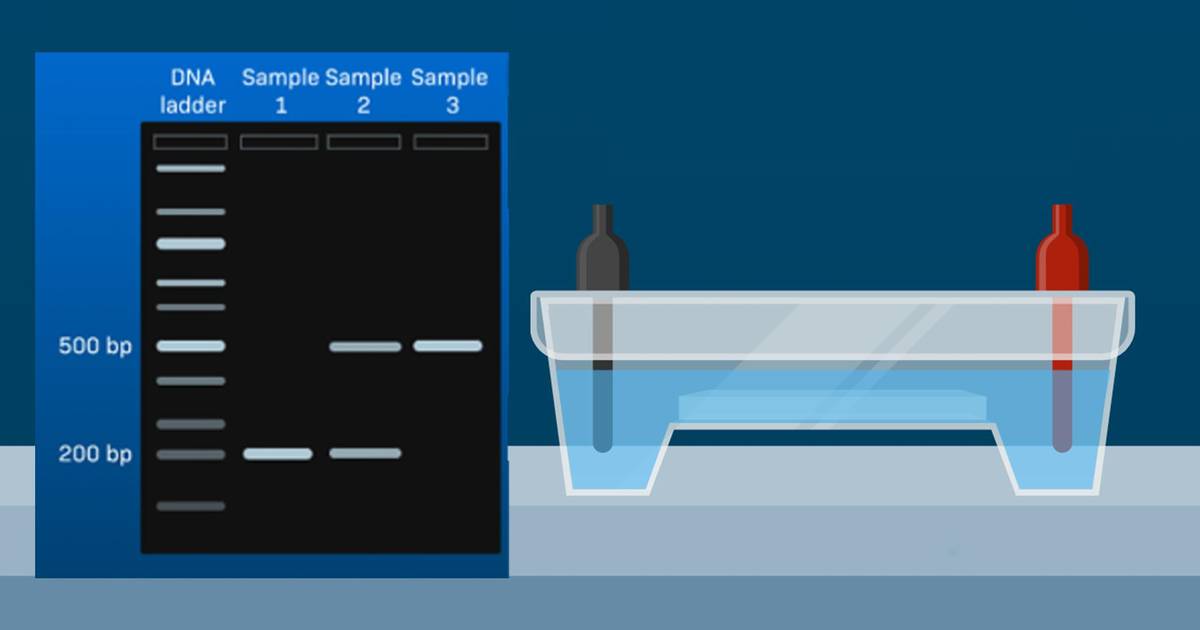 Gel Electrophoresis of ACE Gene