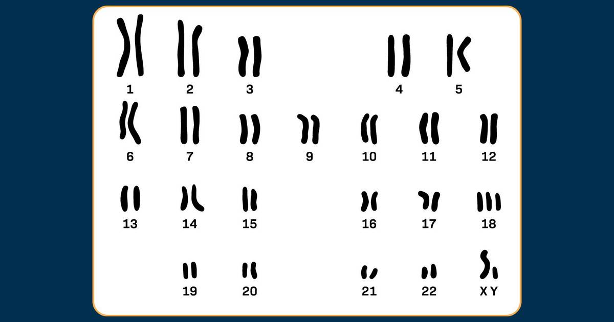 Question Set: Nondisjunction