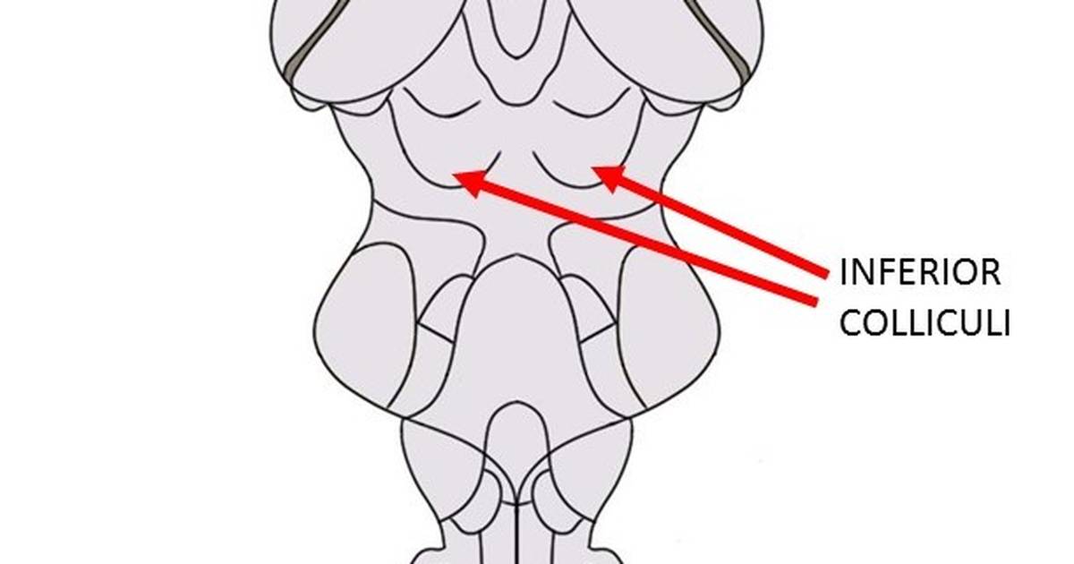 Know Your Brain: Inferior Colliculus