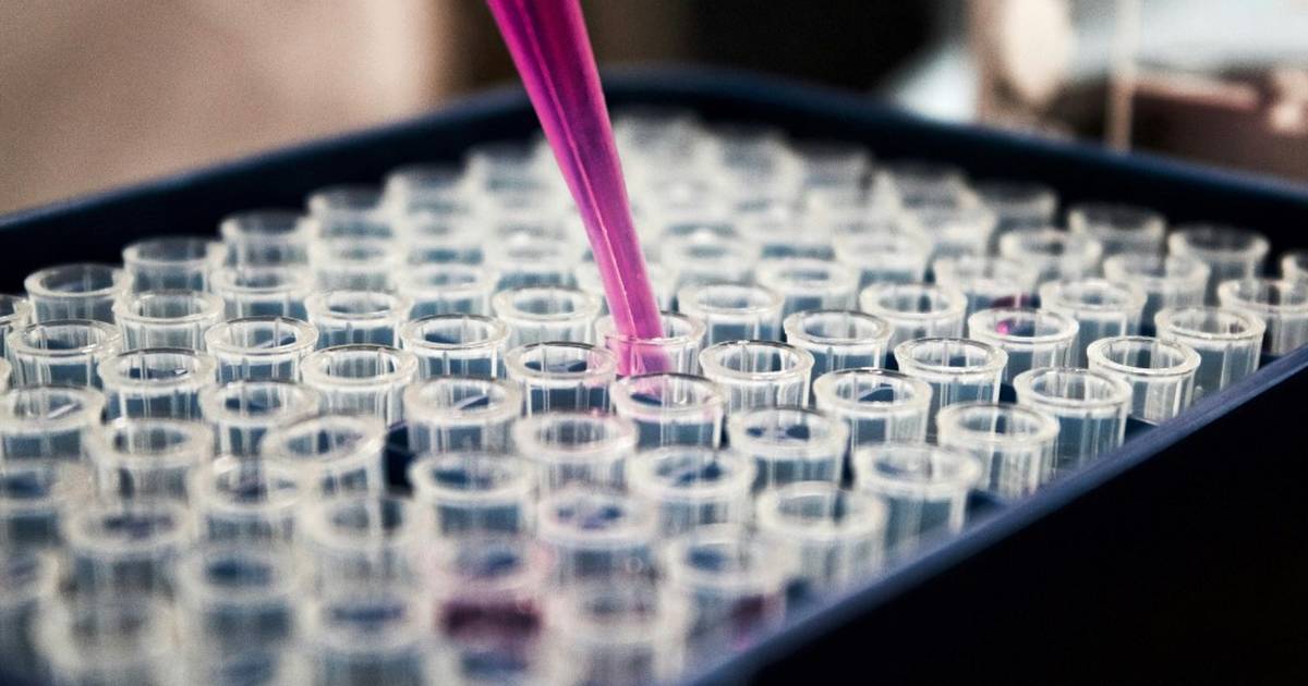 Standard Gel Electrophoresis