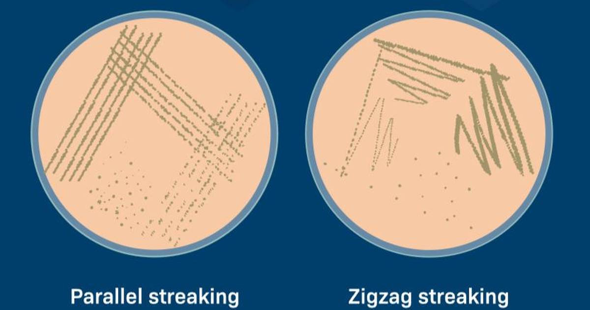 Aseptic Techniques: Streak Plating