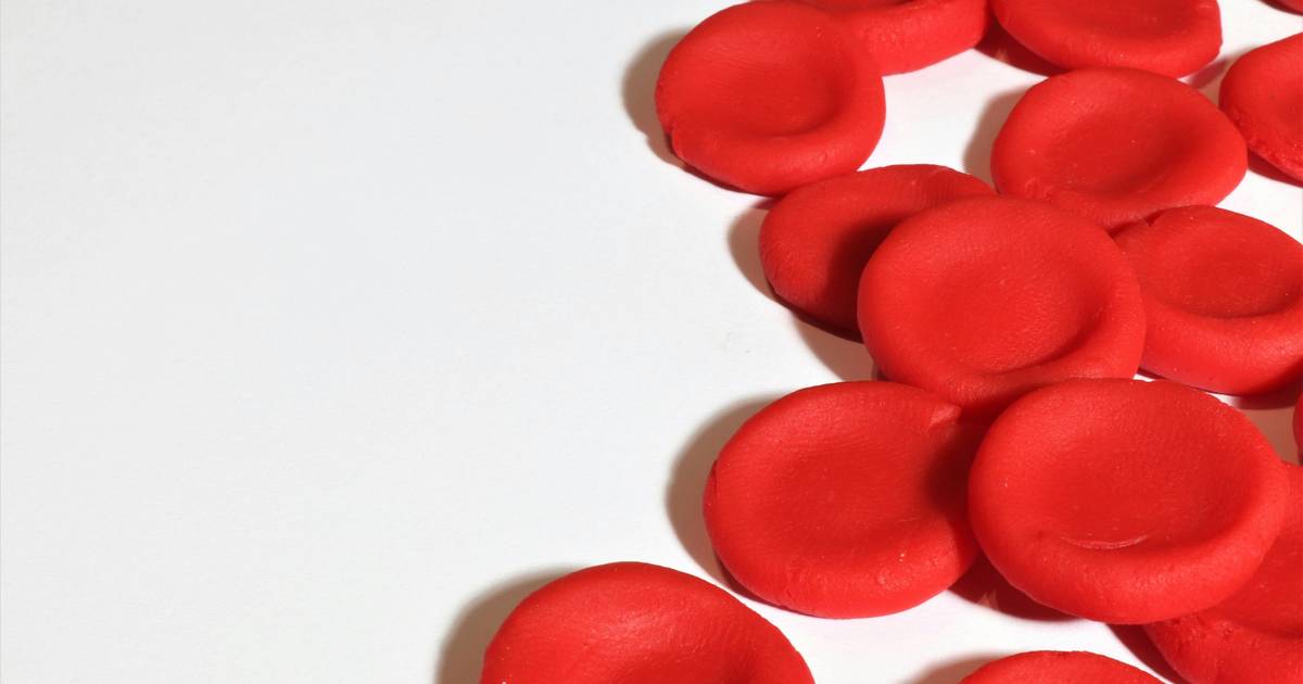 Malaria and Sickle Cell Anemia: Putting an Old Hypothesis to the Test