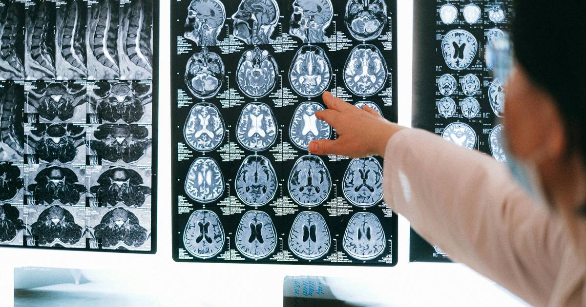 Can Brain Cooling Revolutionise Stroke Treatment?