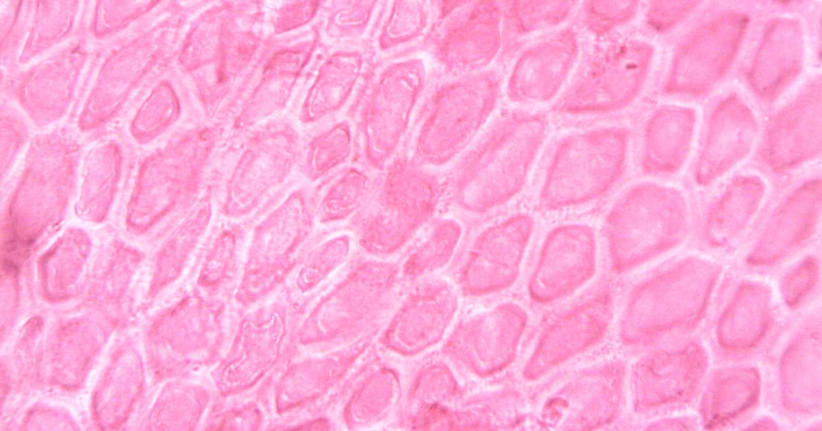 Glucokinase vs Hexokinase: Definition, Mechanism and Function