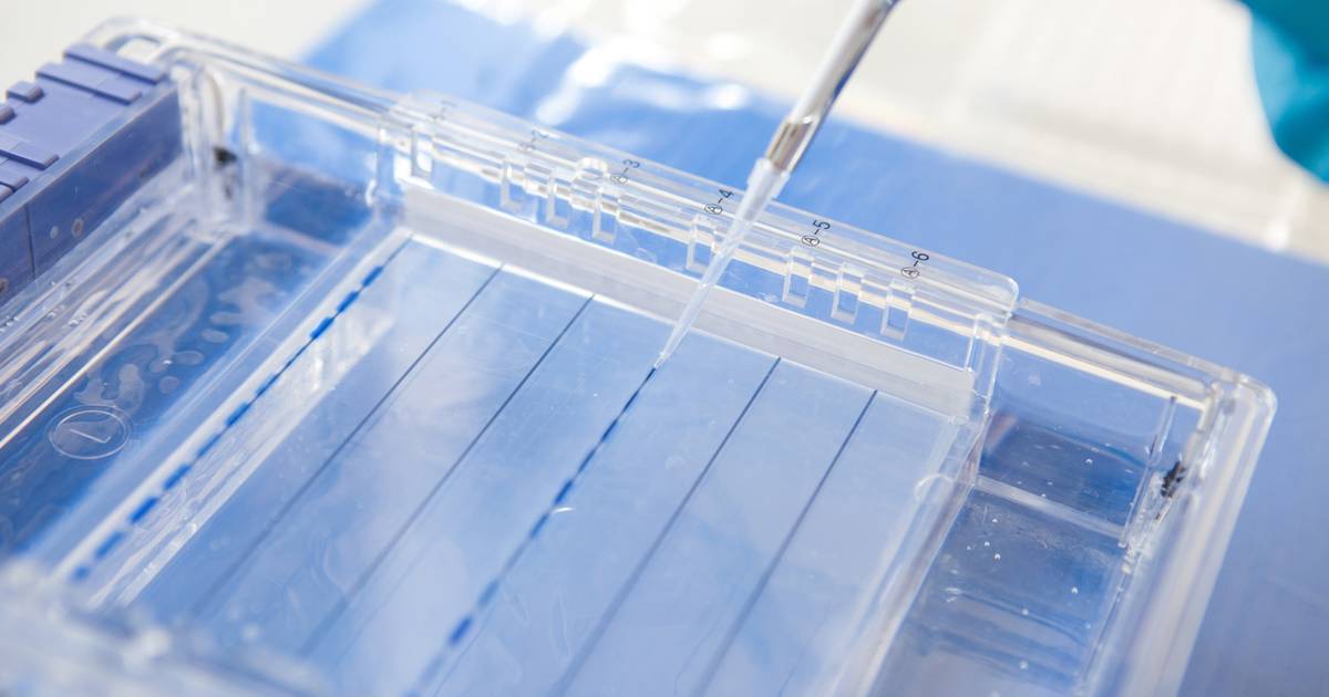 Che cos’è l’elettroforesi su gel?