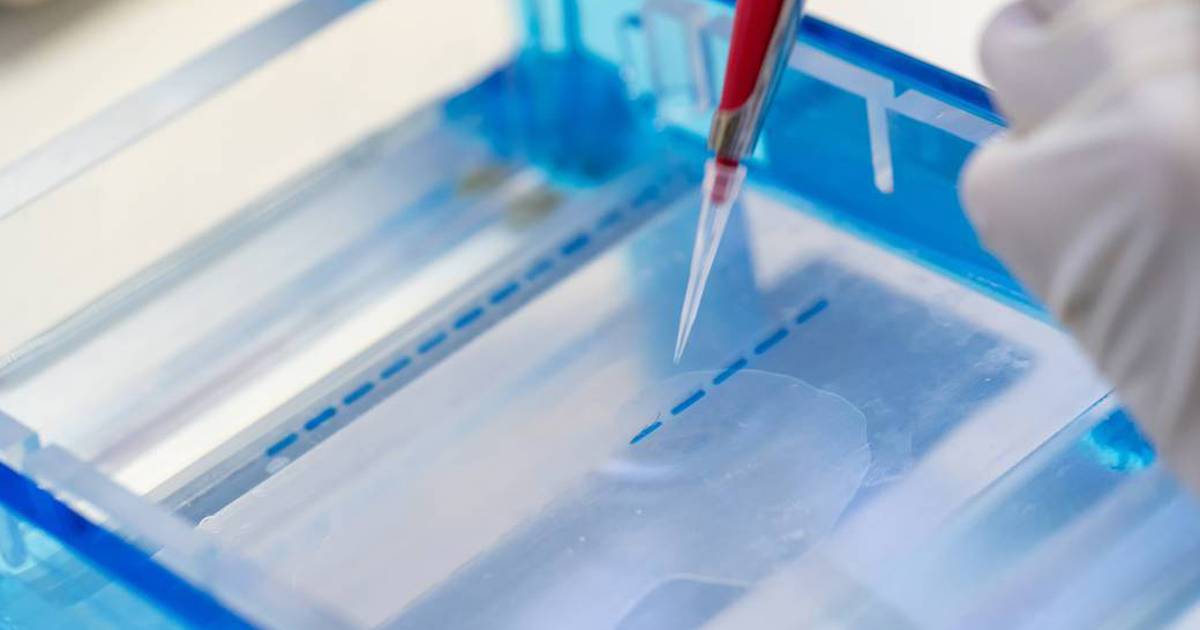 Lesson Plan: Gel Electrophoresis