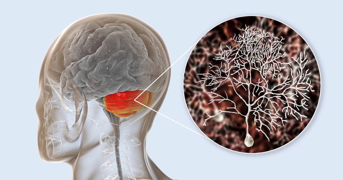 The Mysterious, Multifaceted Cerebellum